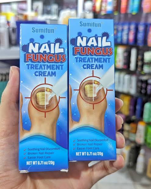 كريم علاج فطريات الأظافر (Nail Fungus Treatment Cream)